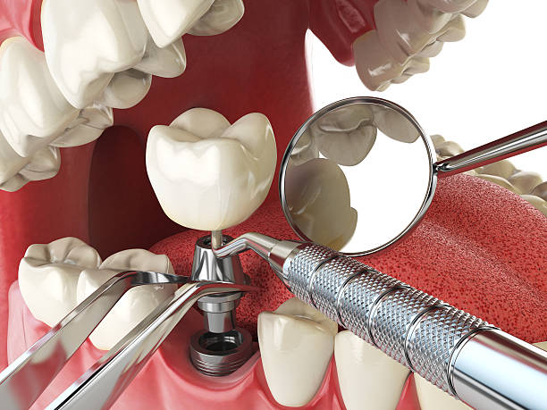 Best Emergency Denture Repair in Holly Lake Ranch, TX